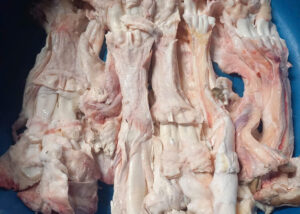 Gân vó (gân chân)